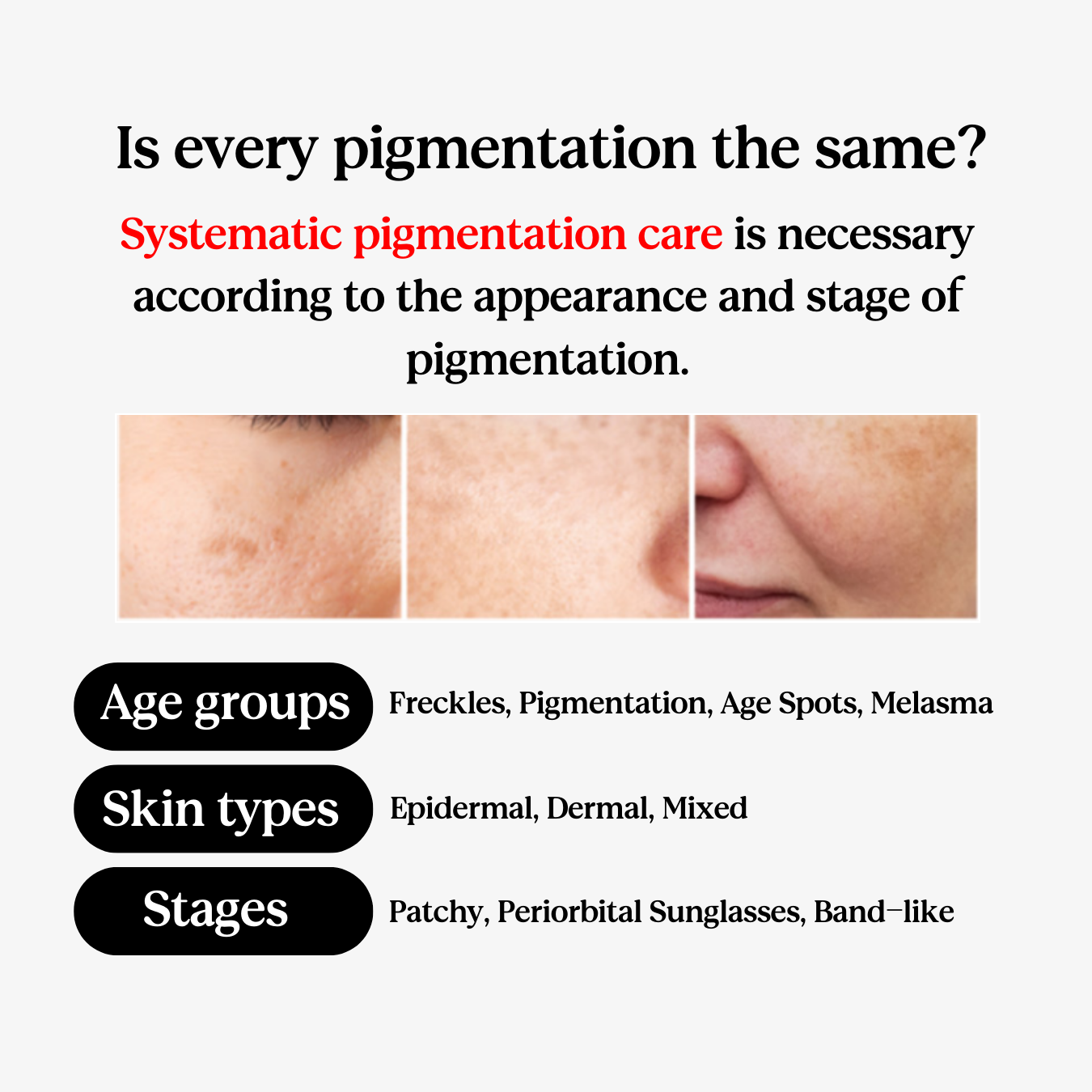 Serum Ndriçues për Lëkurë te pigmentuar