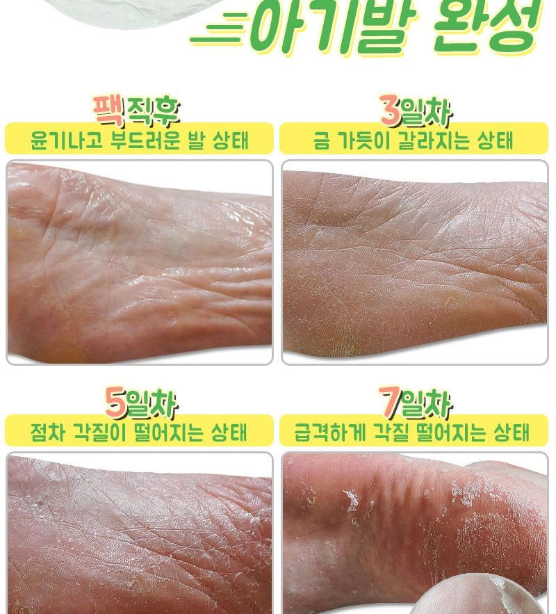 Elizavecca Witch Piggy Hell Pore Turtle’s Foot Pack – Exfoliating Foot Peel Socks for Baby-Soft, Smooth Heels